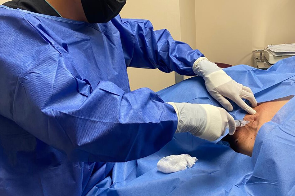 Colocación de catéter temporal de hemodiálisis